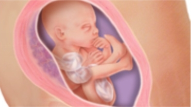 怀孕八个月女胎儿图 8个月怀女孩肚子图片