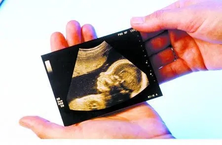 b超单看胎儿性别 怎样从检查单上看胎儿的性别